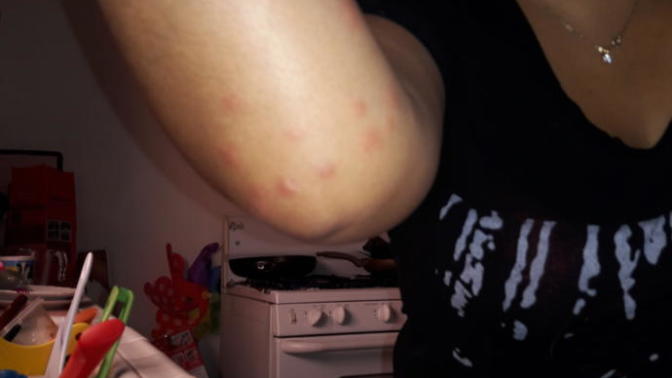Help! 16 Bug Bites on my arm! Please help I geel so disgusted. I dont know what happen or how it happen. Any help?