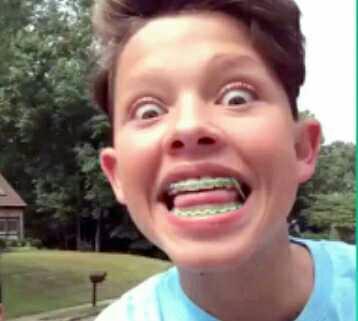 Are braces unattractive on person??