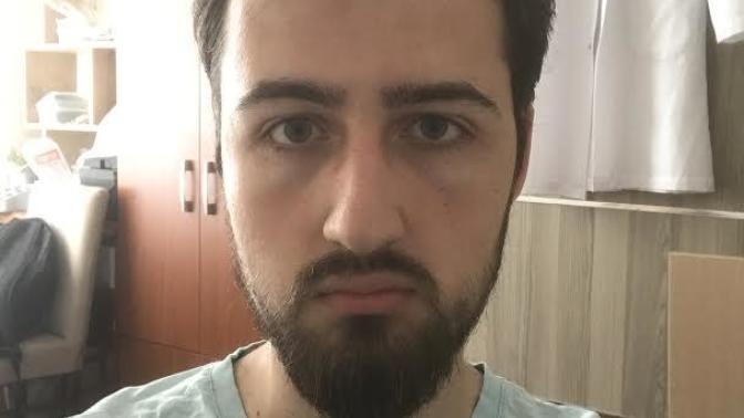 I lost some weight but is my face too slim?