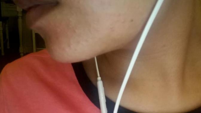 What can I do about my skin?