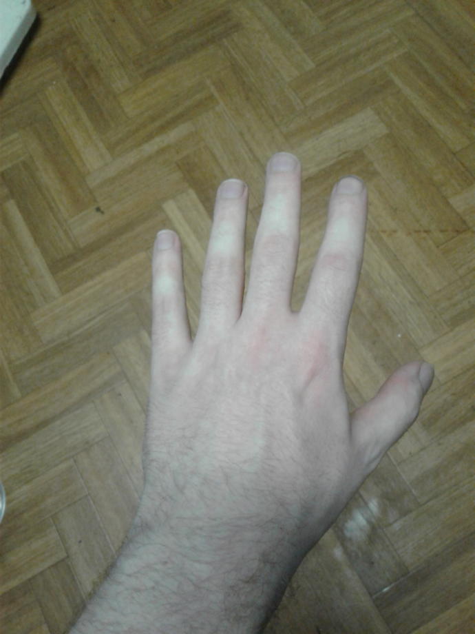 How can I get manlier hands?