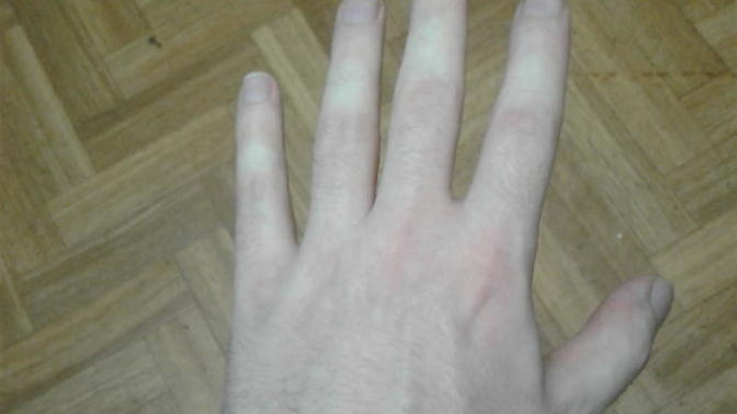 How can I get manlier hands?
