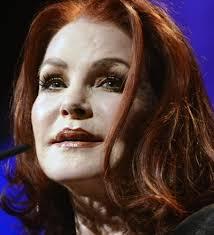Do celebrities go too far with plastic surgery?