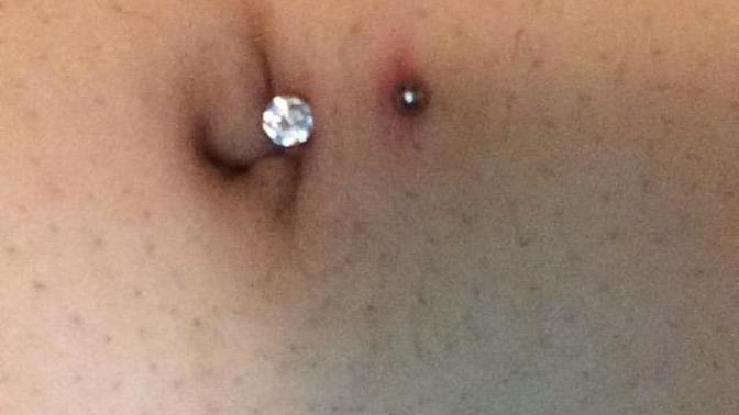 Girls, Does my belly button piercing look infected?