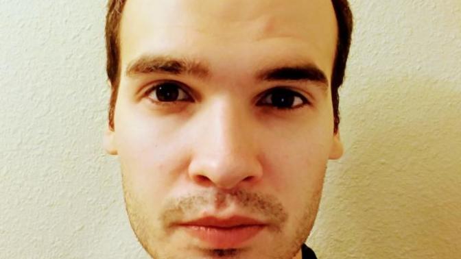 Girls, 23, and my hairline is starting to recede. Will this effect my market value?