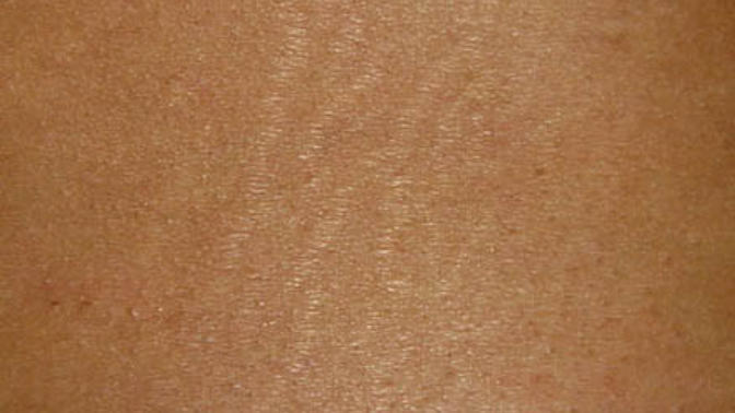 What do guys think of small stretch marks on the hips and thighs?