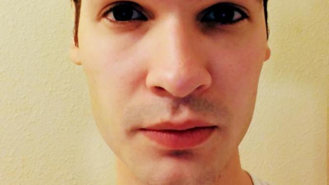 Girls, How do I look with thinning hair?