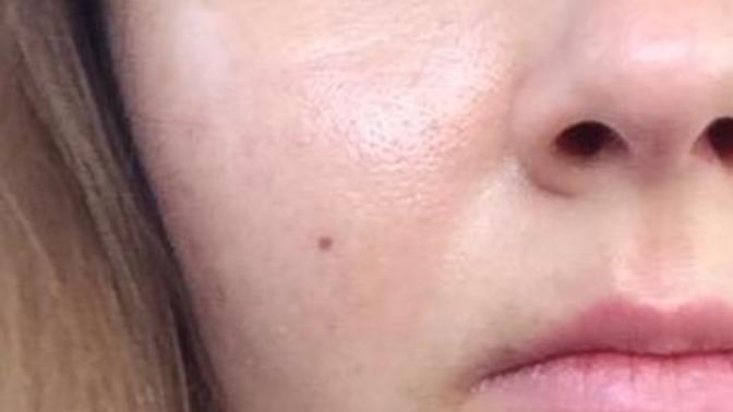 Why is my skin like that (with a picture)?