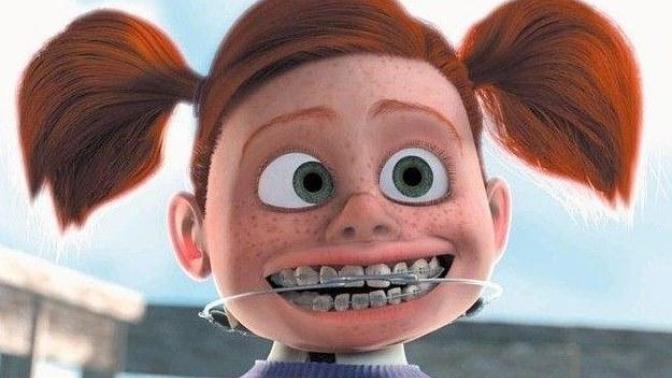Did you ever have braces when you were younger?