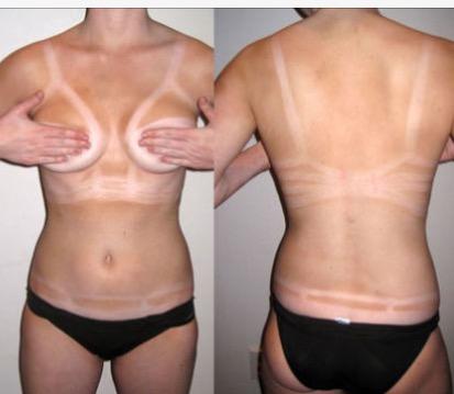 Are tanlines a turn off?