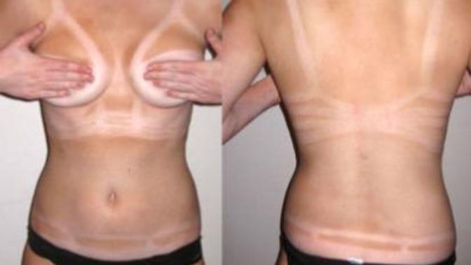 Are tanlines a turn off?
