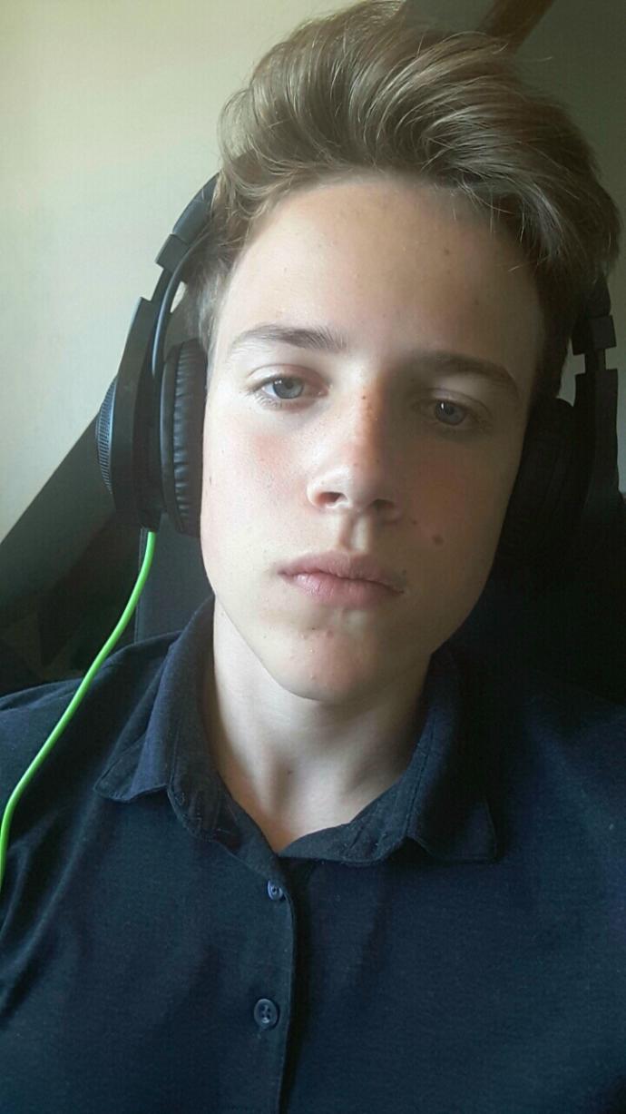Girls, should I remove my mole?