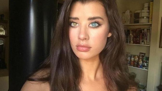 Would you date someone who has two different colored eyes?