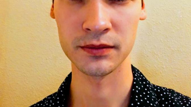 Girls, I have a thinning hairline. Does it look to bad to keep or should I just shave it?