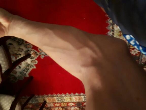 are veins attractive ??