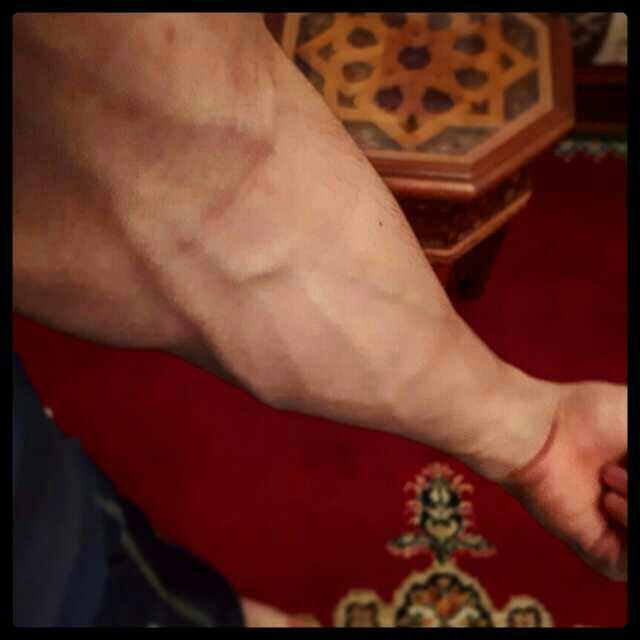 are veins attractive ??