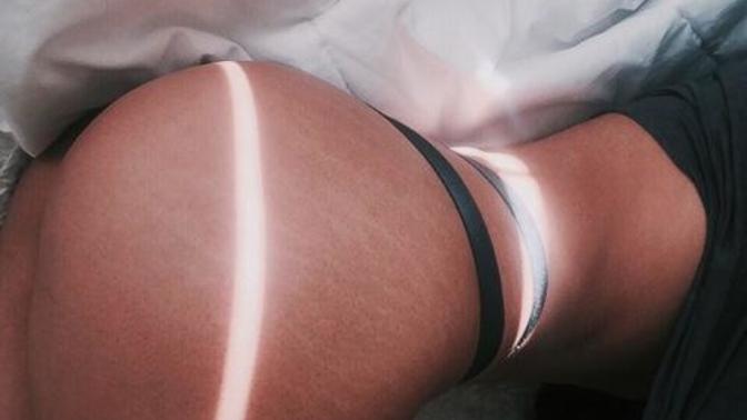 What do y'all think about Stretch marks?