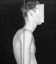 Is bad posture in guys a turn off?