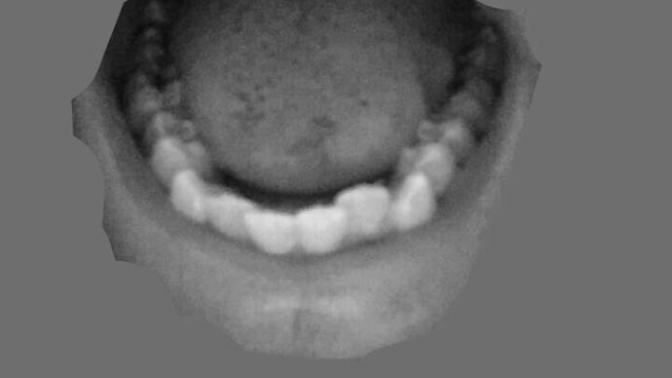 Would you say I need braces?