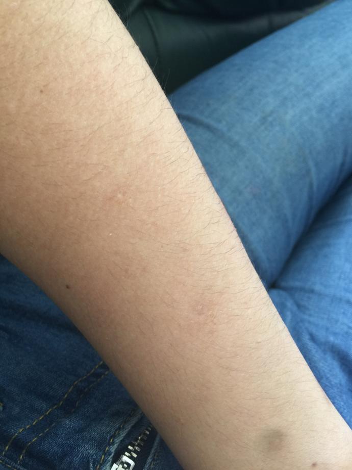 Is My arms to hairy? Should a girl shave her arms?