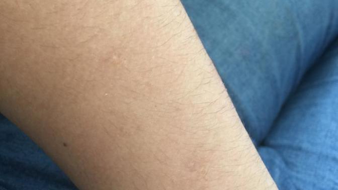Is My arms to hairy? Should a girl shave her arms?