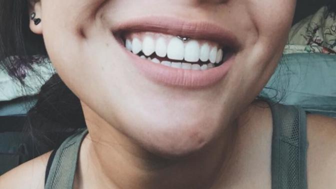 Smiley piercing, yas or nah?