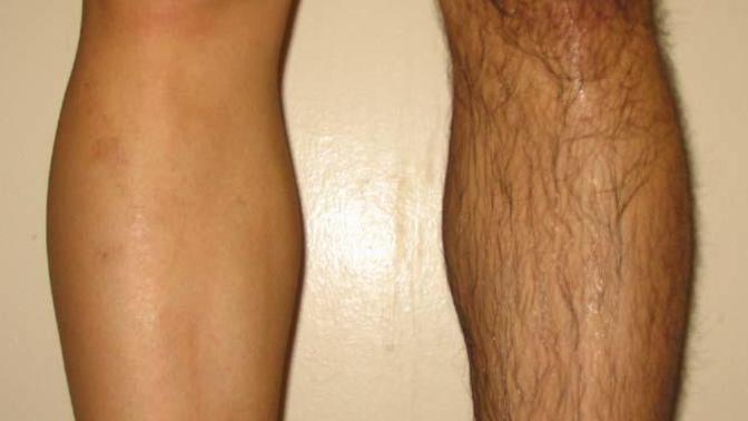 Guys shaving / waxing legs and arms hair... hot or not?