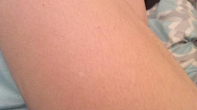 What do you think of these hairy legs?