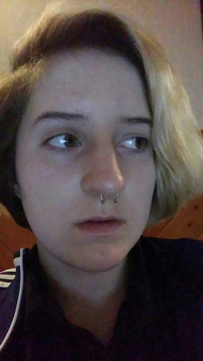 Are thin lips a dealbreaker??