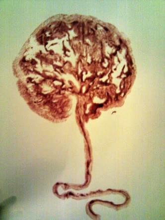Ladies, would you ever consume your placenta after giving birth 😳?