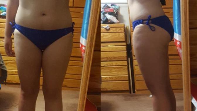 Too much cellulite or fat for a bikini?
