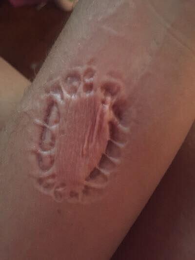 Do guys like when girls bite them?