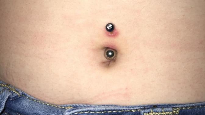 My Navel piercing?