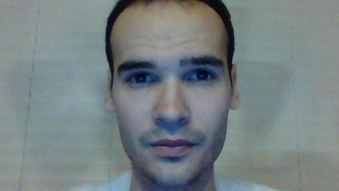 Girls, I have a receding hairline. Will this effect me with women?