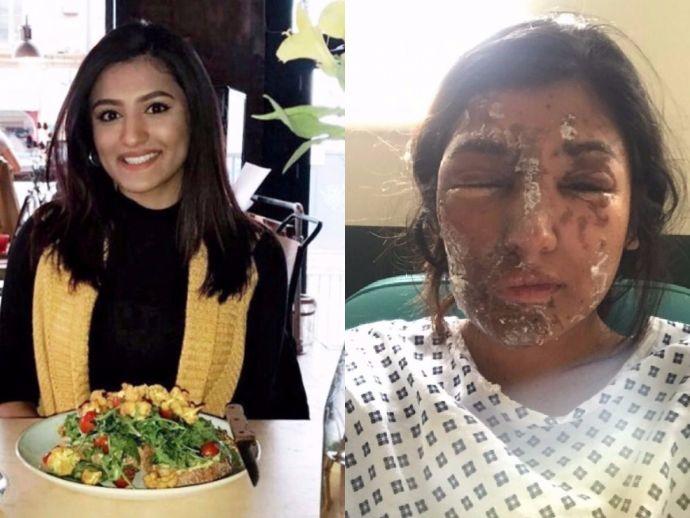 What would you do if your WIFE and her COUSIN got acid thrown at their face. Would you still be with her?