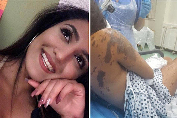 What would you do if your WIFE and her COUSIN got acid thrown at their face. Would you still be with her?