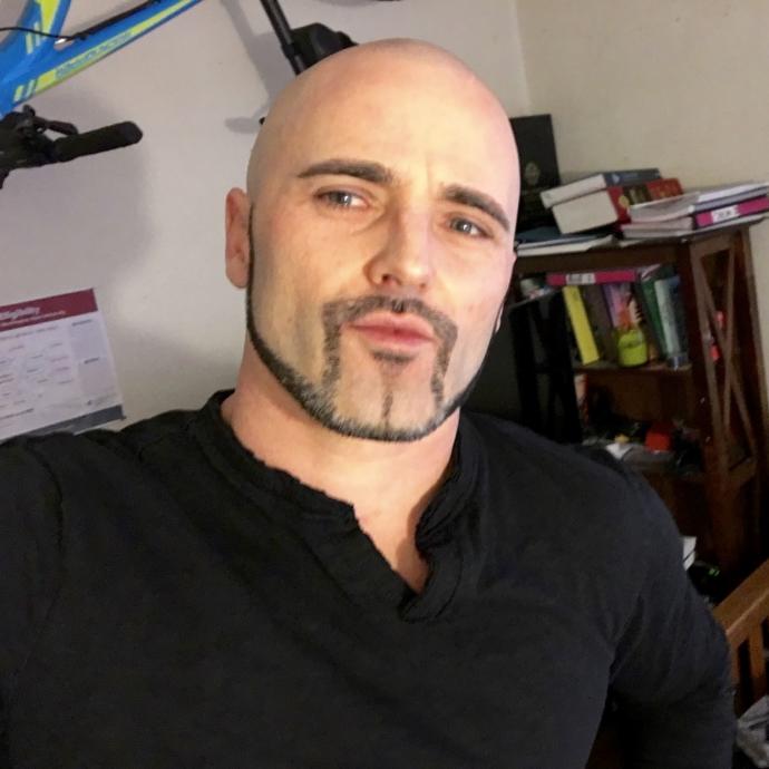 Which looks best on me: shaved head or short thinning grey hair (last two pics show hair but its thinner on top than can be seen)? 