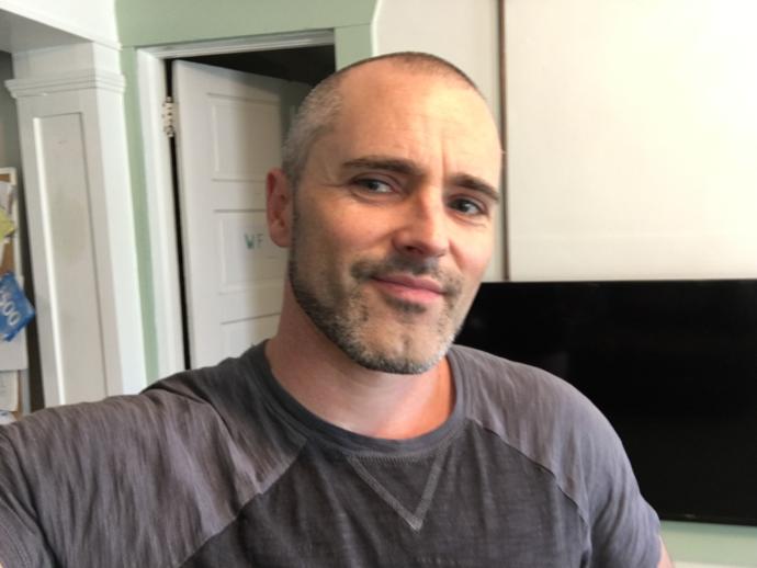 Which looks best on me: shaved head or short thinning grey hair (last two pics show hair but its thinner on top than can be seen)? 