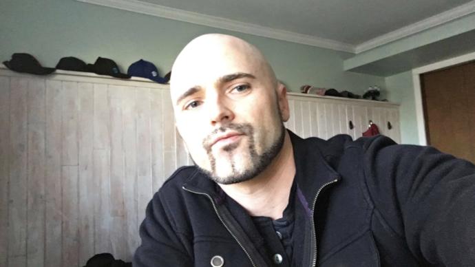 Which looks best on me: shaved head or short thinning grey hair (last two pics show hair but its thinner on top than can be seen)? 