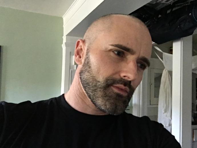 Which looks best on me: shaved head or short thinning grey hair (last two pics show hair but its thinner on top than can be seen)? 