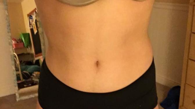 Should I lose weight?