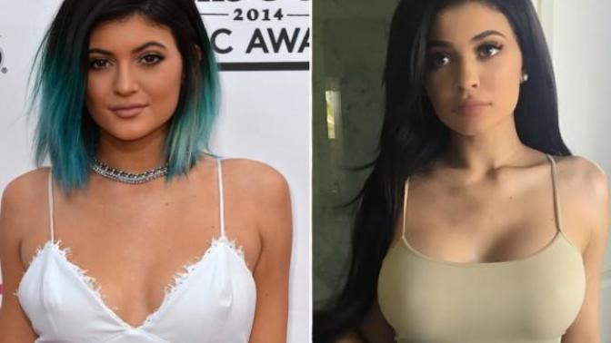 Would getting a boob job change your views on a girl?