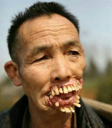 Does Anyone Else Here Think They Are Ugly And Will Die Alone?