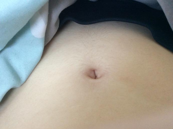 I have belly hair?