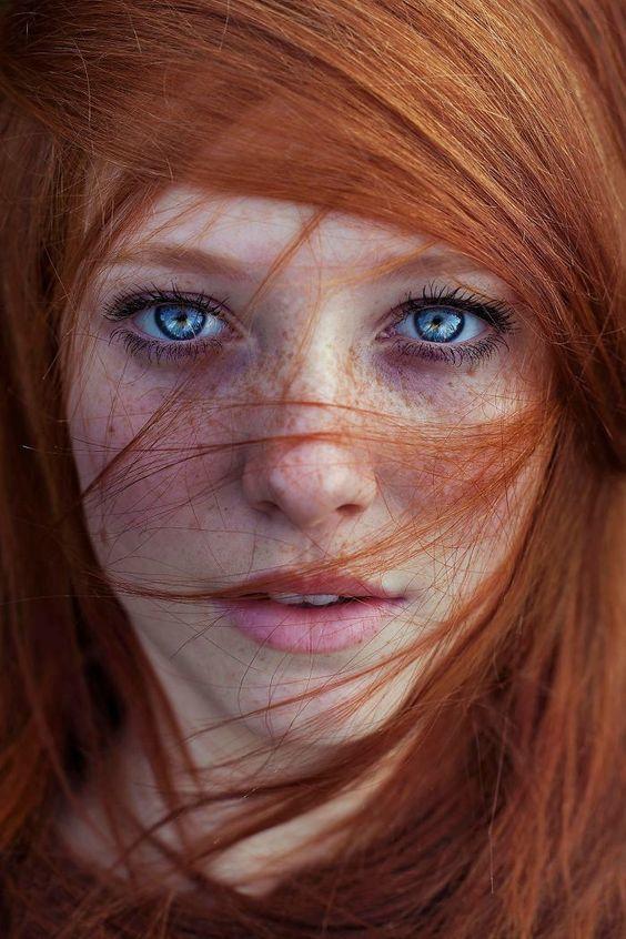 Are freckles attractive??