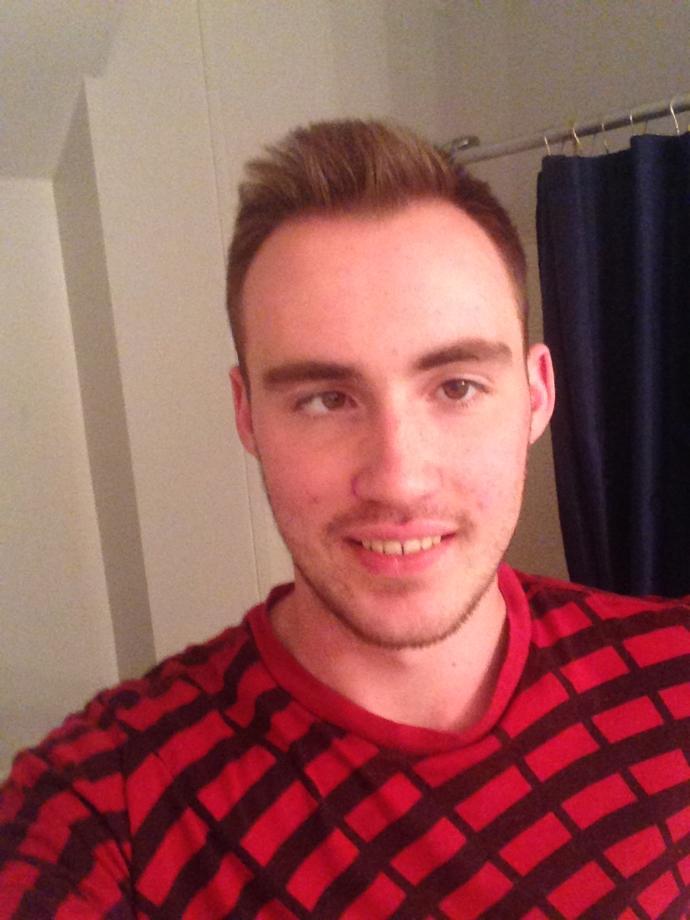 Girls, Should I worry about my lazy eye when dating?(pics) and would it bother you?