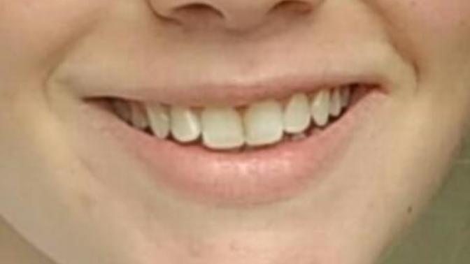 Are my teeth/smile unattractive (pics)?