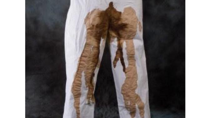 I shit my pants in front of everyone! Not my fault! Is this a turn off?