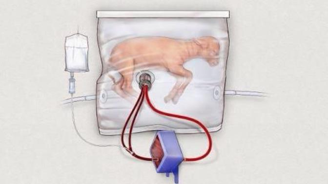 What are you thoughts on artificial wombs?