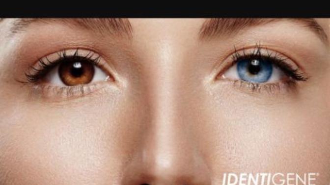 Would you date a men who got laser eye surgery done to change his eye color?